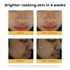 image:imageHimalaya Dark Spot Clearing Turmeric Face Serum Visibly Reduces the Look of Dark Spots with ColdPressed Turmeric Glycolic Acid amp Niacinamide for BrighterLooking Skin 1 fl oz